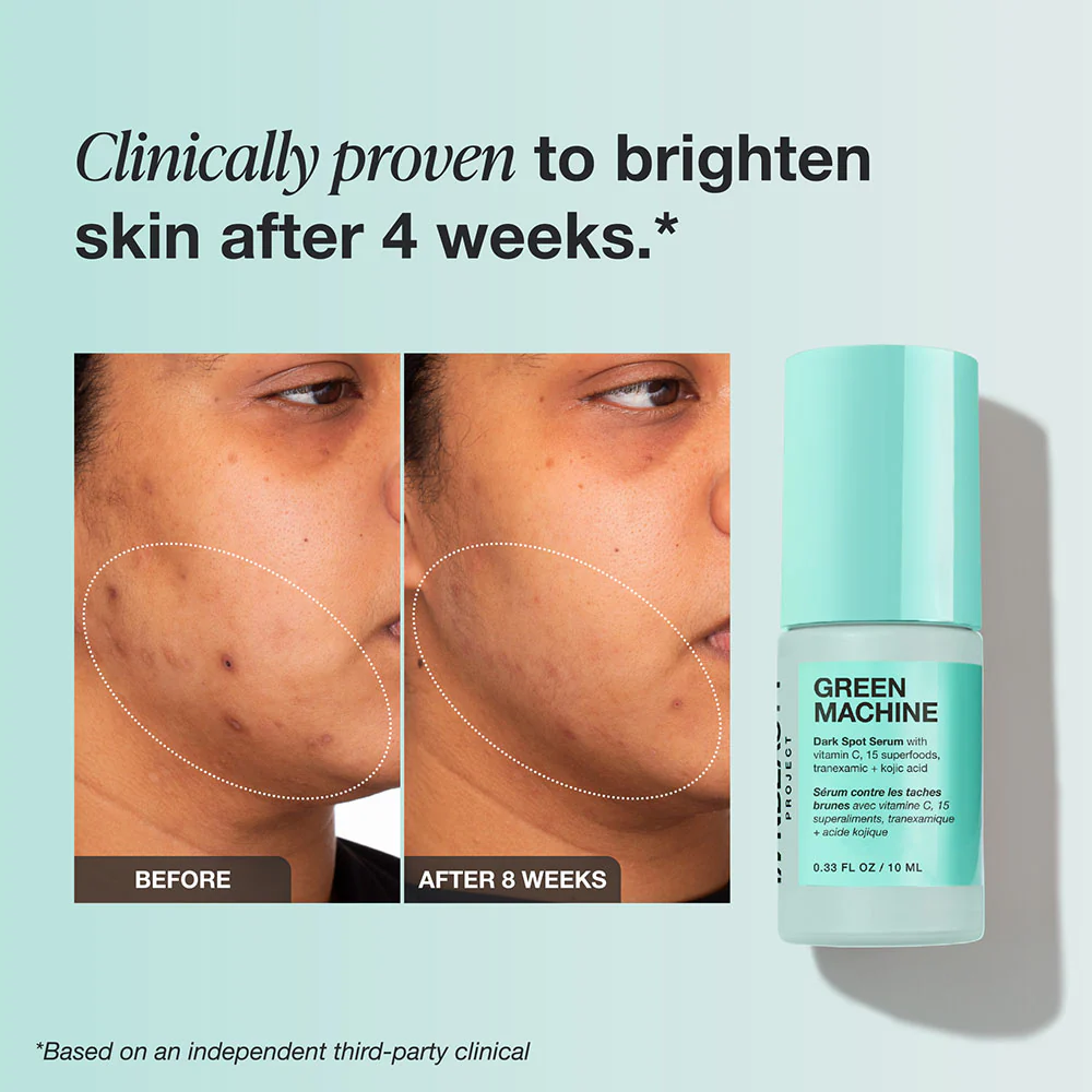 Brightening Essentials Kit - Image 8