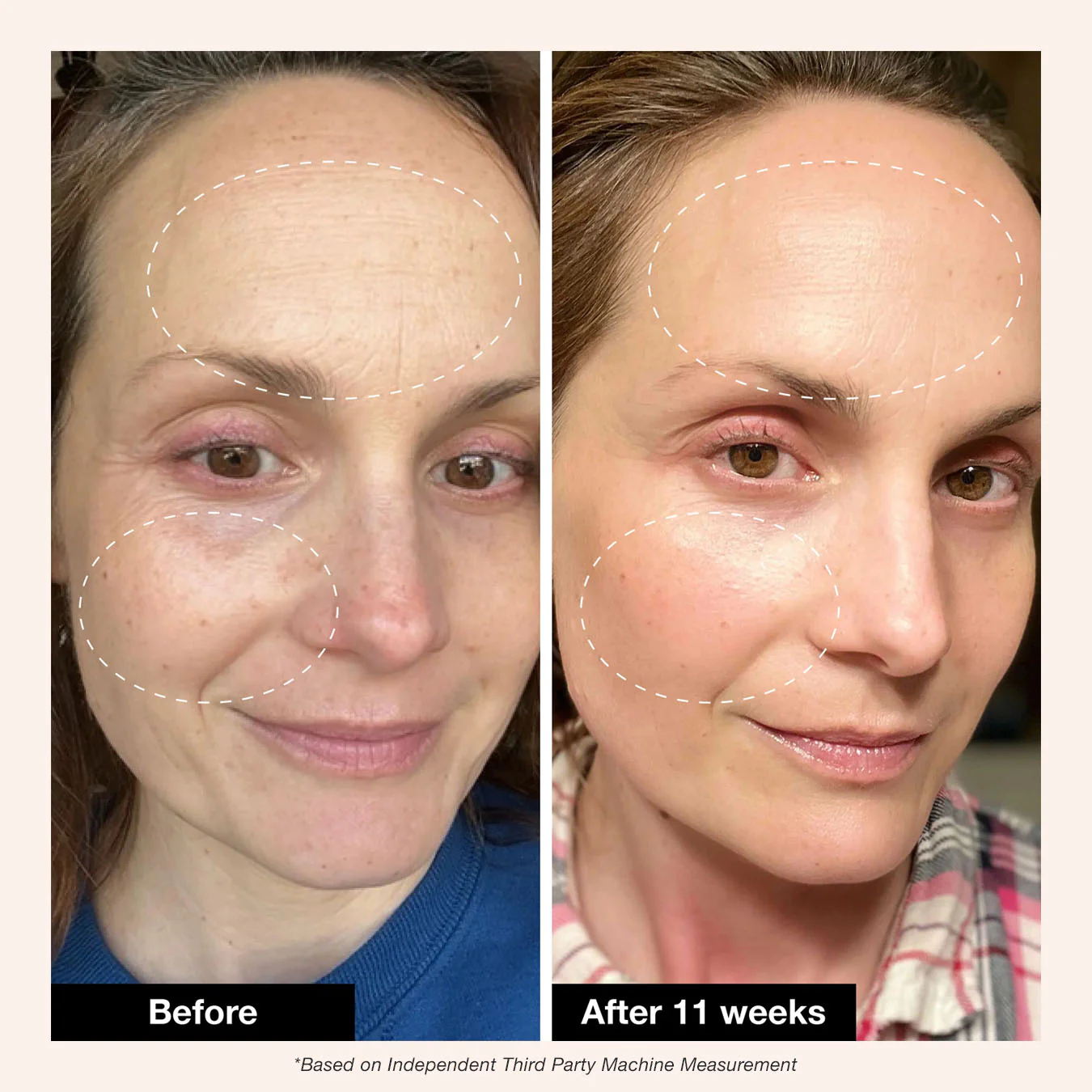Retinol Remix 1% Retinol - Image 4
